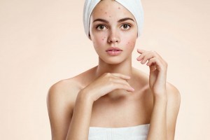 skin treatments type